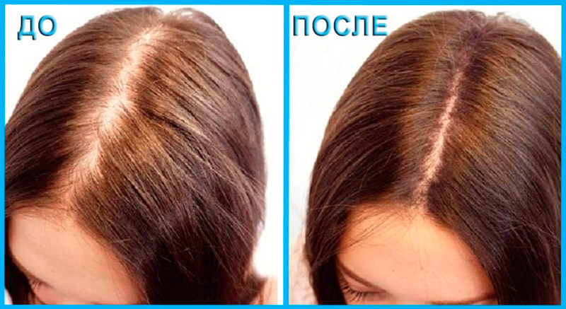Как ускорить рост волос на голове — проверенные способы